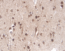 Immunohistochemistry NGFR/TNFRSF16/p75NTR Antibody (74902) [Unconjugated]