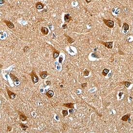 NGL-1/LRRC4C was detected in immersion fixed paraffin-embedded sections of human spinal cord using Mouse Anti-Human NGL-1/LRRC4C Monoclonal Antibody (Catalog # MAB4899) at 15 µg/mL overnight at 4 °C. Tissue was stained using the Anti-Mouse HRP-DAB Cell & Tissue Staining Kit (brown; Catalog # CTS002) and counter-stained with hematoxylin (blue). Specific staining was localized to the dorsal horn. View our protocol for Chromogenic IHC Staining of Paraffin-embedded Tissue Sections.