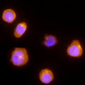 NK1R was detected in immersion fixed THP-1 human acute monocytic leukemia cell line using Mouse Anti-Human NK1R Monoclonal Antibody (Catalog # MAB66871) at 25 µg/mL for 3 hours at room temperature. Cells were stained using the NorthernLights™ 557-conjugated Anti-Mouse IgG Secondary Antibody (yellow; Catalog # NL007) and counterstained with DAPI (blue). Specific staining was localized to plasma membrane and cytoplasm. View our protocol for Fluorescent ICC Staining of Non-adherent Cells.
