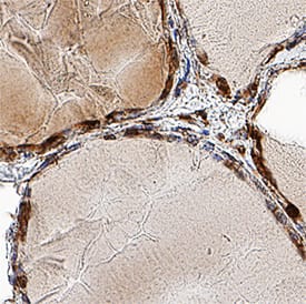 TTF-1/NKX2-1 was detected in immersion fixed paraffin-embedded sections of human thyroid using Rabbit Anti-Human TTF-1/NKX2-1 Monoclonal Antibody (Catalog # MAB94581) at 5 µg/mL for 1 hour at room temperature followed by incubation with the Anti-Mouse IgG VisUCyte™ HRP Polymer Antibody (Catalog # VC001). Tissue was stained using DAB (brown) and counterstained with hematoxylin (blue). Specific staining was localized to nuclei. View our protocol for IHC Staining with VisUCyte HRP Polymer Detection Reagents.