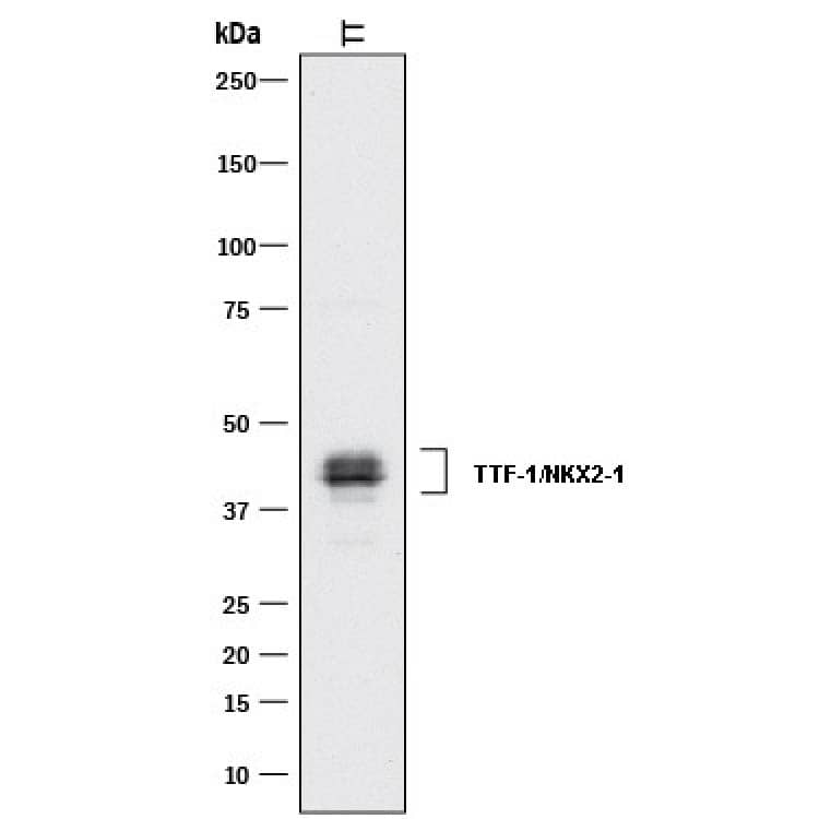 Western blot shows lysates of TT human medullary thyroid cancer cell line. PVDF membrane was probed with 1 µg/mL of Rabbit Anti-Human TTF-1/NKX2-1 Monoclonal Antibody (Catalog # MAB9458) followed by HRP-conjugated Anti-Rabbit IgG Secondary Antibody (Catalog # HAF008). Specific bands were detected for TTF-1/NKX2-1 at approximately 40-45 kDa (as indicated). This experiment was conducted under reducing conditions and using Immunoblot Buffer Group 1.