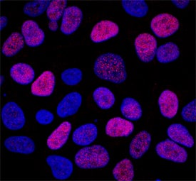 NKX2.2 was detected in immersion fixed A673 human Ewing sarcoma cell line using Mouse Anti-Human/Mouse/Rat NKX2.2 Monoclonal Antibody (Catalog # MAB8167) at 10 µg/mL for 3 hours at room temperature. Cells were stained using the NorthernLights™ 557-conjugated Anti-Mouse IgG Secondary Antibody (red; Catalog # NL007) and counterstained with DAPI (blue). Specific staining was localized to nuclei. View our protocol for Fluorescent ICC Staining of Cells on Coverslips.