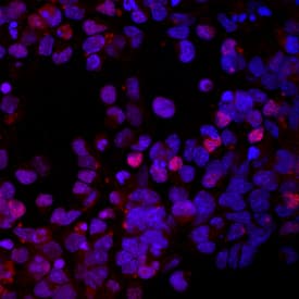 NKX2.2 was detected in immersion fixed rat cortical stem cells differentiated for 7 days using Mouse Anti-Human/Mouse/Rat NKX2.2 Monoclonal Antibody (Catalog # MAB8167) at 10 µg/mL for 3 hours at room temperature. Cells were stained using the NorthernLights™ 557-conjugated Anti-Mouse IgG Secondary Antibody (red; Catalog # NL007) and counterstained with DAPI (blue). Specific staining was localized to nuclei. View our protocol for Fluorescent ICC Staining of Stem Cells on Coverslips.