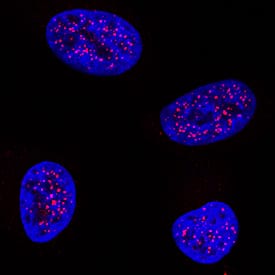 TTF-1/NKX2-1 was detected in immersion fixed A549 human lung carcinoma cell line using Rabbit Anti-Human TTF-1/NKX2-1 Monoclonal Antibody (Catalog # MAB94581) at 3 µg/mL for 3 hours at room temperature. Cells were stained using the NorthernLights™ 557-conjugated Anti-Rabbit IgG Secondary Antibody (red; Catalog # NL004) and counterstained with DAPI (blue). Specific staining was localized to nuclei. View our protocol for Fluorescent ICC Staining of Cells on Coverslips.