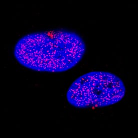 TTF-1/NKX2-1 was detected in immersion fixed A549 human lung carcinoma cell line using Rabbit Anti-Human TTF-1/NKX2-1 Monoclonal Antibody (Catalog # MAB9458) at 3 µg/mL for 3 hours at room temperature. Cells were stained using the NorthernLights™ 557-conjugated Anti-Rabbit IgG Secondary Antibody (red; Catalog # NL004) and counterstained with DAPI (blue). Specific staining was localized to nuclei. View our protocol for Fluorescent ICC Staining of Cells on Coverslips.