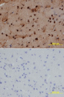 NKX2.5 was detected in immersion fixed paraffin-embedded sections of human heart using Mouse Anti-Human NKX2.5 Monoclonal Antibody (Catalog # MAB2444) at 25 µg/mL overnight at 4 °C. Tissue was stained using the Anti-Mouse HRP-DAB Cell & Tissue Staining Kit (brown; Catalog # CTS002) and counterstained with hematoxylin (blue). Lower panel shows a lack of labeling if primary antibodies are omitted and tissue is stained only with secondary antibody followed by incubation with detection reagents. View our protocol for Chromogenic IHC Staining of Paraffin-embedded Tissue Sections.