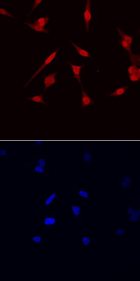Immunocytochemistry NKX3.1 Antibody