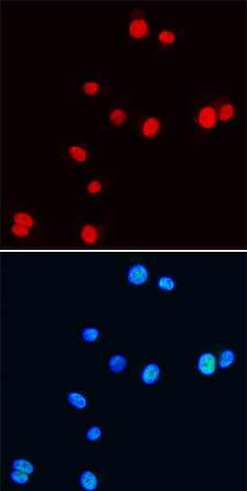 NKX3.1 was detected in immersion fixed NIH-3T3 mouse embryonic fibroblast cell line using Rat Anti-Mouse NKX3.1 Monoclonal Antibody (Catalog # MAB6475) at 25 µg/mL for 3 hours at room temperature. Cells were stained using the NorthernLights™ 557-conjugated Anti-Rat IgG Secondary Antibody (red, upper panel; Catalog # NL013) and counterstained with DAPI (blue, lower panel). Specific staining was localized to nuclei. View our protocol for Fluorescent ICC Staining of Cells on Coverslips.