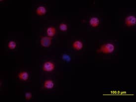 NKp46/NCR1 was detected in immersion fixed NK-92 human natural killer lymphoma cell line using Goat Anti-Human NKp46/NCR1 Antigen Affinity-purified Polyclonal Antibody (Catalog # AF1850) at 10 µg/mL for 3 hours at room temperature. Cells were stained using the NorthernLights™ 557-conjugated Anti-Goat IgG Secondary Antibody (red; Catalog # NL001) and counterstained with DAPI (blue). View our protocol for Fluorescent ICC Staining of Non-adherent Cells.
