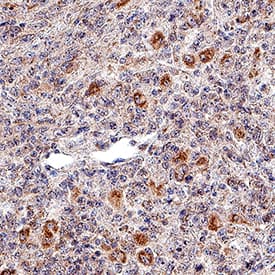 NKp46/NCR1 was detected in immersion fixed paraffin-embedded sections of human lymph node using Goat Anti-Human NKp46/NCR1 Antigen Affinity-purified Polyclonal Antibody (Catalog # AF1850) at 3 µg/mL for 1 hour at room temperature followed by incubation with the Anti-Goat IgG VisUCyte™ HRP Polymer Antibody (Catalog # VC004). Tissue was stained using DAB (brown) and counterstained with hematoxylin (blue). Specific staining was localized to cytoplasm. View our protocol for IHC Staining with VisUCyte HRP Polymer Detection Reagents.
