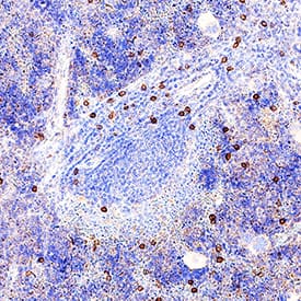 NKp46/NCR1 was detected in perfusion fixed frozen sections of mouse spleen using Goat Anti-Mouse NKp46/NCR1 Antigen Affinity-purified Polyclonal Antibody (Catalog # AF2225) at 3 µg/mL for 1 hour at room temperature followed by incubation with the Anti-Goat IgG VisUCyte™ HRP Polymer Antibody (Catalog # VC004). Tissue was stained using DAB (brown) and counterstained with hematoxylin (blue). Specific staining was localized to cytoplasm in lymphocytes. View our protocol for IHC Staining with VisUCyte HRP Polymer Detection Reagents.