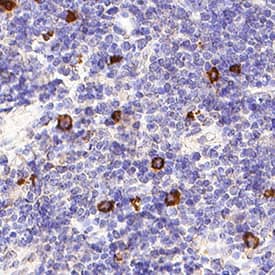 NKp46/NCR1 was detected in immersion fixed paraffin-embedded sections of human tonsil using Mouse Anti-Human NKp46/NCR1 Monoclonal Antibody (Catalog # MAB1850) at 5 µg/mL for 1 hour at room temperature followed by incubation with the Anti-Mouse IgG VisUCyte™ HRP Polymer Antibody (Catalog # VC001). Before incubation with the primary antibody, tissue was subjected to heat-induced epitope retrieval using Antigen Retrieval Reagent-Basic (Catalog # CTS013). Tissue was stained using DAB (brown) and counterstained with hematoxylin (blue). Specific staining was localized to natural killer cells in germinal center. View our protocol for IHC Staining with VisUCyte HRP Polymer Detection Reagents.
