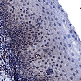 NLRP3/NALP3 was detected in immersion fixed paraffin-embedded sections of human tonsil using Mouse Anti-Human NLRP3/NALP3 Monoclonal Antibody (Catalog # MAB67893) at 5 µg/mL for 1 hour at room temperature followed by incubation with the Anti-Mouse IgG VisUCyte™ HRP Polymer Antibody (Catalog # VC001). Before incubation with the primary antibody, tissue was subjected to heat-induced epitope retrieval using Antigen Retrieval Reagent-Basic (Catalog # CTS013). Tissue was stained using DAB (brown) and counterstained with hematoxylin (blue). Specific staining was localized to cell nuclei. View our protocol for IHC Staining with VisUCyte HRP Polymer Detection Reagents.