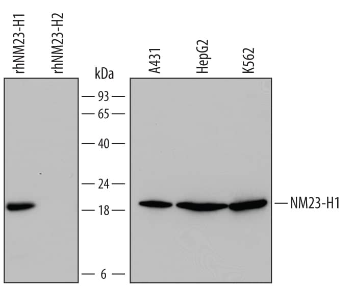 Western blot shows lysates of A431 human epithelial carcinoma cell line, HepG2 human hepatocellular carcinoma cell line, and K562 human chronic myelogenous leukemia cell line. PVDF Membrane was probed with 0.5 µg/mL of Mouse Anti-Human NM23-H1 Monoclonal Antibody (Catalog # MAB6256) followed by HRP-conjugated Anti-Mouse IgG Secondary Antibody (Catalog # HAF007). For additional reference, recombinant human NM23-H1 and recombinant human NM23-H2 (10 ng/lane) were included. A specific band was detected for NM23-H1 at approximately 20 kDa (as indicated). This experiment was conducted under reducing conditions and using Immunoblot Buffer Group 2.