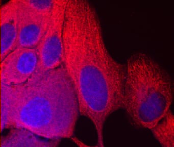 Immunocytochemistry NM23-H1/H2 Antibody