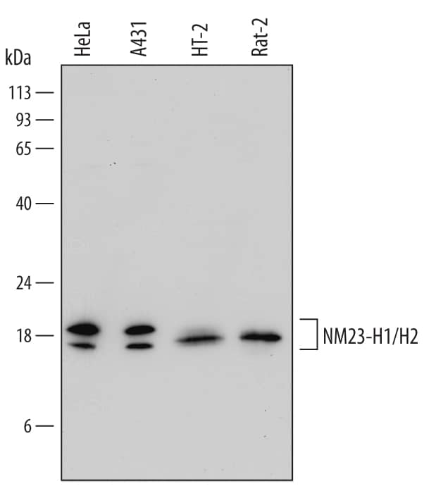 Western Blot NM23-H1/H2 Antibody