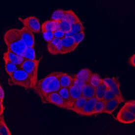 NM23-H2 was detected in immersion fixed MCF-7 human breast cancer cell line using Sheep Anti-Human NM23-H2 Antigen Affinity-purified Polyclonal Antibody (Catalog # AF6665) at 10 µg/mL for 3 hours at room temperature. Cells were stained using the NorthernLights™ 557-conjugated Anti-Sheep IgG Secondary Antibody (red; Catalog # NL010) and counterstained with DAPI (blue). Specific staining was localized to cytoplasm. View our protocol for Fluorescent ICC Staining of Cells on Coverslips.