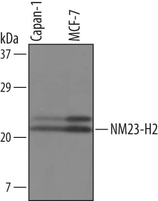 Western blot shows lysates of Capan-1 human pancreatic adenocarcinoma cell line and MCF-7 human breast cancer cell line. PVDF Membrane was probed with 1 µg/mL of Sheep Anti-Human NM23-H2 Polyclonal Antibody (Catalog # AF6665) followed by HRP-conjugated Anti-Sheep IgG Secondary Antibody (Catalog # HAF016). Specific bands were detected for NM23-H2 at approximately 20 and 23 kDa (as indicated). This experiment was conducted under reducing conditions and using Immunoblot Buffer Group 8.