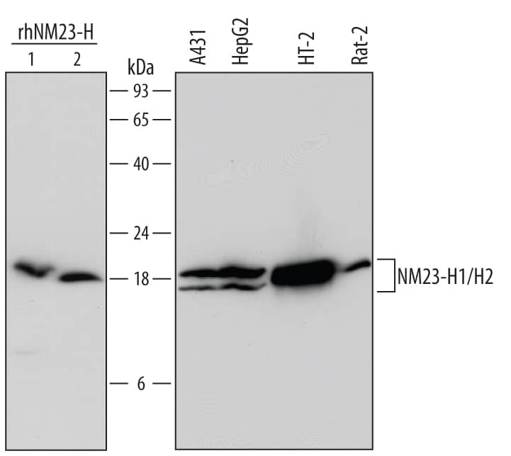 Western Blot NM23-H1/H2 Antibody (642825)