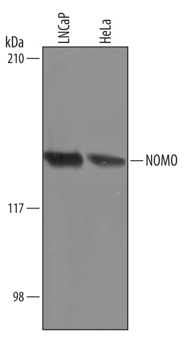 Western blot shows lysates of LNCaP human prostate cancer cell line and HeLa human cervical epithelial carcinoma cell line. PVDF Membrane was probed with 1 µg/mL of Goat Anti-Human NOMO Antigen Affinity-purified Polyclonal Antibody (Catalog # AF3755) followed by HRP-conjugated Anti-Goat IgG Secondary Antibody (Catalog # HAF019). A specific band was detected for NOMO at approximately 130 kDa (as indicated). This experiment was conducted under reducing conditions and using Immunoblot Buffer Group 8.