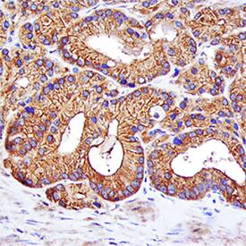 NOV/CCN3 was detected in immersion fixed paraffin-embedded sections of human prostate using Goat Anti-Human NOV/CCN3 Biotinylated Antigen Affinity-purified Polyclonal Antibody (Catalog # BAF1640) at 15 µg/mL overnight at 4 °C. Tissue was stained using the Anti-Goat HRP-DAB Cell & Tissue Staining Kit (brown; Catalog # CTS008) and counterstained with hematoxylin (blue). Specific staining was localized to cytoplasm and plasma membrane. View our protocol for Chromogenic IHC Staining of Paraffin-embedded Tissue Sections.