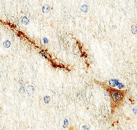 Immunohistochemistry NPDC-1 Antibody