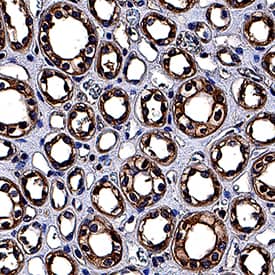 Immunohistochemistry NPRA/NPR1 Antibody (377018) [Unconjugated]