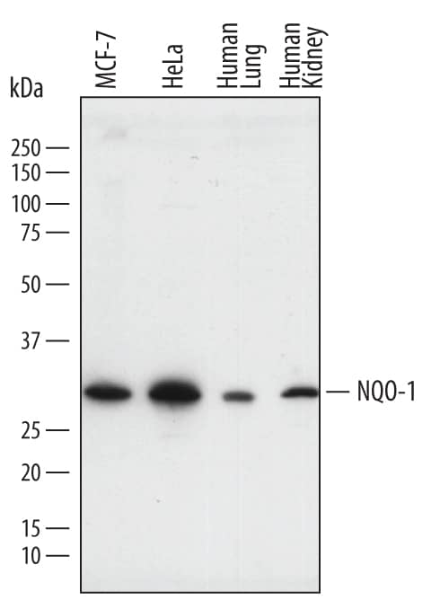 Western blot shows lysates of MCF-7 human breast cancer cell line, HeLa human cervical epithelial carcinoma cell line, human lung tissue, and human kidney tissue. PVDF membrane was probed with 0.25 µg/mL of Sheep Anti-Human NQO-1 Antigen Affinity-purified Polyclonal Antibody (Catalog # AF7567) followed by HRP-conjugated Anti-Sheep IgG Secondary Antibody (Catalog # HAF016). A specific band was detected for NQO-1 at approximately 30 kDa (as indicated). This experiment was conducted under reducing conditions and using Immunoblot Buffer Group 1.