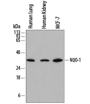 Western blot shows lysates of human lung tissue, human kidney tissue, and MCF-7 human breast cancer cell line. PVDF membrane was probed with 0.5 µg/mL of Mouse Anti-Human NQO-1 Monoclonal Antibody (Catalog # MAB7567) followed by HRP-conjugated Anti-Mouse IgG Secondary Antibody (Catalog # HAF018). A specific band was detected for NQO-1 at approximately 30 kDa (as indicated). This experiment was conducted under reducing conditions and using Immunoblot Buffer Group 1.