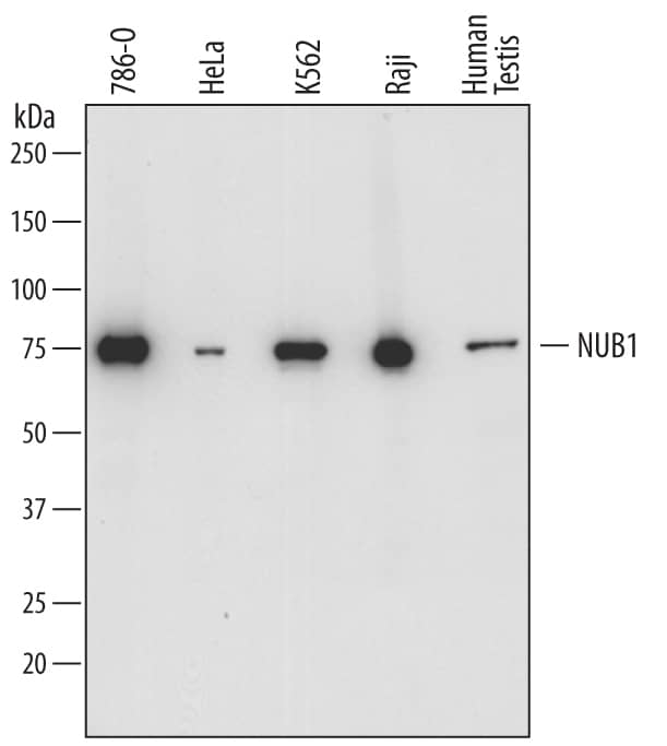 Western blot shows lysates of 786-O human renal cell adenocarcinoma cell line, HeLa human cervical epithelial carcinoma cell line, K562 human chronic myelogenous leukemia cell line, Raji human Burkitt's lymphoma cell line, and human testis tissue. PVDF membrane was probed with 0.5 µg/mL of Sheep Anti-Human NUB1 Antigen Affinity-purified Polyclonal Antibody (Catalog # AF7336) followed by HRP-conjugated Anti-Sheep IgG Secondary Antibody (HAF016). A specific band was detected for NUB1 at approximately 75 kDa (as indicated). This experiment was conducted under reducing conditions and using Immunoblot Buffer Group 1.