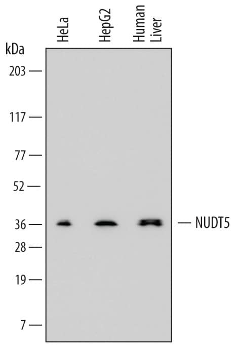 Western blot shows lysates of HeLa human cervical epithelial carcinoma cell line, HepG2 human hepatocellular carcinoma cell line, and human liver tissue. PVDF membrane was probed with 0.2 µg/mL of Mouse Anti-Human ADP-Sugar Pyrophosphatase/NUDT5 Monoclonal Antibody (Catalog # MAB6414) followed by HRP-conjugated Anti-Mouse IgG Secondary Antibody (Catalog # HAF007). A specific band was detected for ADP-Sugar Pyrophosphatase/NUDT5 at approximately 36 kDa (as indicated). This experiment was conducted under reducing conditions and using Immunoblot Buffer Group 1.