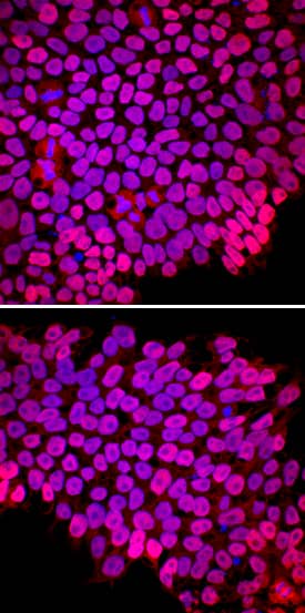 Nanog was detected in immersion fixed ADLF1 (top panel) and FAB2 (bottom panel) induced pluripotent stem cell lines using Goat Anti-Human Nanog Antigen Affinity-purified Polyclonal Antibody (Catalog # AF1997) at 10 µg/mL for 3 hours at room temperature. Cells were stained using the NorthernLights™ 557-conjugated Anti-Goat IgG Secondary Antibody (red; NL001) and counterstained with DAPI (blue). Specific staining was localized to nuclei. View our protocol for Fluorescent ICC Staining of Stem Cells on Coverslips.