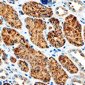 Immunohistochemistry Napsin A Antibody [Unconjugated]