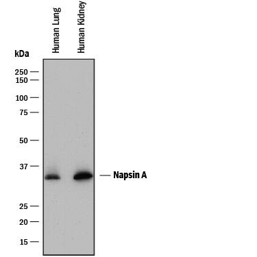Western Blot Napsin A Antibody [Unconjugated]