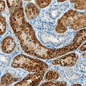 Napsin A was detected in immersion fixed paraffin-embedded sections of human kidney using Rabbit Anti-Human Napsin A Monoclonal Antibody (Catalog # MAB8489) at 1 µg/mL overnight at 4 °C. Tissue was stained using the Anti-Rabbit HRP-DAB Cell & Tissue Staining Kit (brown; Catalog # CTS005) and counterstained with hematoxylin (blue). Specific staining was localized to cytoplasm in convoluted tubules. View our protocol for Chromogenic IHC Staining of Paraffin-embedded Tissue Sections.