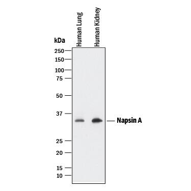 Western blot shows lysates of human lung tissue and human kidney tissue. PVDF membrane was probed with 0.5 µg/mL of Rabbit Anti-Human Napsin A Monoclonal Antibody (Catalog # MAB8489) followed by HRP-conjugated Anti-Rabbit IgG Secondary Antibody (Catalog # HAF008). A specific band was detected for Napsin A at approximately 35 kDa (as indicated). This experiment was conducted under reducing conditions and using Immunoblot Buffer Group 1.