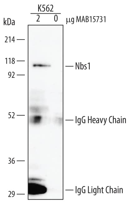 Nbs1 was immunoprecipitated from 500 µg of K562 human chronic myelogenous leukemia cell line lysate following incubation with 2 µg Mouse Anti-Human/Mouse Nbs1 Mono-clonal Antibody (Catalog # MAB15731) for 1 hour on ice. Nbs1-antibody complexes were absorbed using goat anti-mouse IgG-agarose (Sigma). Immunoprecipitated Nbs1 was detected by Western blot using 1 µg/mL Human/Mouse/Rat Nbs1 Mono-clonal Antibody (Catalog # MAB1573). View our recommended buffer recipes for immunoprecipitation.