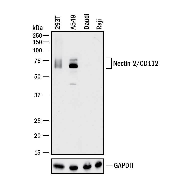 Western blot shows lysates of 293T human embryonic kidney cell line, A549 human lung carcinoma cell line, Daudi human Burkitt's lymphoma cell line, and Raji human Burkitt's lymphoma cell line. PVDF membrane was probed with 0.1 µg/mL of Goat Anti-Human Nectin-2/CD112 Antigen Affinity-purified Polyclonal Antibody (Catalog # AF2229) followed by HRP-conjugated Anti-Goat IgG Secondary Antibody (Catalog # HAF017). A specific band was detected for Nectin-2/CD112 at approximately 60-75 kDa (as indicated). Daudi human Burkitt's lymphoma cell line and Raji human Burkitt's lymphoma cell line are shown as negative controls. GAPDH (Catalog # AF5718) is shown as a loading control.This experiment was conducted under reducing conditions and using Immunoblot Buffer Group 1.