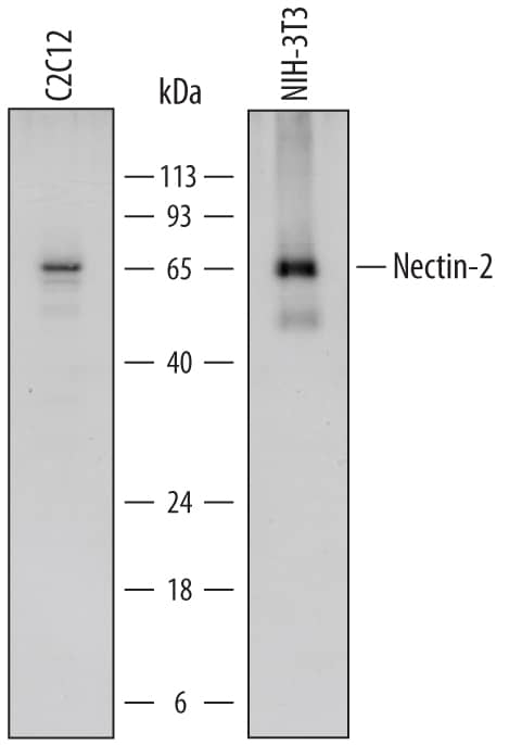 Western blot shows lysates of C2C12 mouse myoblast cell line and NIH-3T3 mouse embryonic fibroblast cell line. PVDF Membrane was probed with 1 µg/mL of Mouse Nectin-2/CD112 Antigen Affinity-purified Polyclonal Antibody (Catalog # AF3869) followed by HRP-conjugated Anti-Sheep IgG Secondary Antibody (Catalog # HAF016). A specific band was detected for Nectin-2/CD112 at approximately 65-70 kDa (as indicated). This experiment was conducted under reducing conditions and using Immunoblot Buffer Group 1.