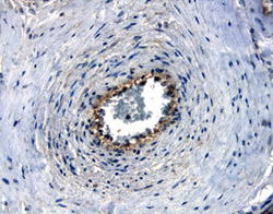 Nectin-4 was detected in immersion fixed paraffin-embedded sections of human placenta using 10 µg/mL Goat Anti-Human Nectin-4 Antigen Affinity-purified Polyclonal Antibody (Catalog # AF2659) overnight at 4 °C. Before incubation with the primary antibody tissue was subjected to heat-induced epitope retrieval using Antigen Retrieval Reagent-Basic (CTS013). Tissue was stained with the Anti-Goat HRP-DAB Cell & Tissue Staining Kit (brown; CTS008) and counterstained with hematoxylin (blue). View our protocol for Chromogenic IHC Staining of Paraffin-embedded Tissue Sections.