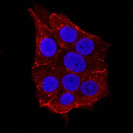 Nectin-2/CD112 was detected in immersion fixed MCF-7 human breast cancer cell line using Goat Anti-Human Nectin-2/CD112 Antigen Affinity-purified Polyclonal Antibody (Catalog # AF2229) at 1.7 µg/mL for 3 hours at room temperature. Cells were stained using the NorthernLights™ 557-conjugated Anti-Goat IgG Secondary Antibody (red; Catalog # NL001) and counterstained with DAPI (blue). Specific staining was localized to cytoplasm. View our protocol for Fluorescent ICC Staining of Cells on Coverslips.