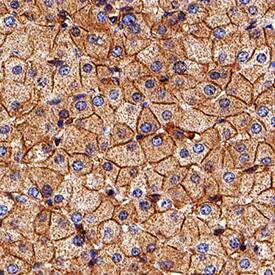 Nectin-2/CD112 was detected in immersion fixed paraffin-embedded sections of human liver using Goat Anti-Human Nectin-2/CD112 Antigen Affinity-purified Polyclonal Antibody (Catalog # AF2229) at 3 µg/mL for 1 hour at room temperature followed by incubation with the Anti-Goat IgG VisUCyte™ HRP Polymer Antibody (Catalog # VC004). Tissue was stained using DAB (brown) and counterstained with hematoxylin (blue). Specific staining was localized to cell membrane. View our protocol for IHC Staining with VisUCyte HRP Polymer Detection Reagents.