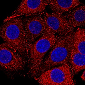 Nectin-2/CD112 was detected in immersion fixed MCF-7 human breast cancer cell line using Mouse Anti-Human Nectin-2/CD112 Monoclonal Antibody (Catalog # MAB22292) at 5 µg/mL for 3 hours at room temperature. Cells were stained using the NorthernLights™ 557-conjugated Anti-Mouse IgG Secondary Antibody (red; Catalog # NL007) and counterstained with DAPI (blue). Specific staining was localized to cytoplasm. View our protocol for Fluorescent ICC Staining of Cells on Coverslips.