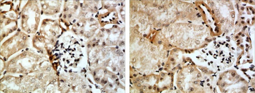 Immunohistochemistry: Neogenin Antibody (RM0124-3G55) [NBP1-22501]