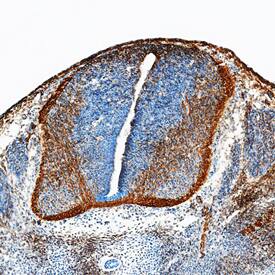 Neogenin was detected in perfusion fixed frozen sections of mouse embryo (15 d.p.c.) using Goat Anti-Human/Mouse Neogenin Antigen Affinity-purified Polyclonal Antibody (Catalog # AF1079) at 15 µg/mL overnight at 4 °C. Tissue was stained using the Anti-Goat HRP-DAB Cell & Tissue Staining Kit (brown; CTS008) and counterstained with hematoxylin (blue). Specific staining was localized to developing neurons. View our protocol for Chromogenic IHC Staining of Frozen Tissue Sections.