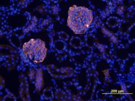 Nephrin was detected in perfusion fixed frozen sections of mouse kidney using Goat Anti-Mouse Nephrin Antigen Affinity-purified Polyclonal Antibody (Catalog # AF3159) at 10 µg/mL overnight at 4 °C. Tissue was stained using the NorthernLights™ 557-conjugated Anti-Goat IgG Secondary Antibody (yellow; Catalog # NL001) and counterstained with DAPI (blue). View our protocol for Fluorescent IHC Staining of Frozen Tissue Sections.