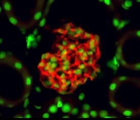 Nephrin was detected in perfusion fixed frozen sections of mouse kidney using 10 &micro;g/mL Goat Anti-Mouse Nephrin Antigen Affinity-purified Polyclonal Antibody (Catalog # AF3159) overnight at 4 &deg;C. Tissue was stained with the NorthernLights&trade; 557-conjugated Anti-Goat IgG Secondary Antibody (red; Catalog # NL001) and counterstained (green). View our protocol for Fluorescent IHC Staining of Frozen Tissue Sections.