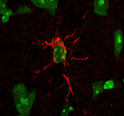 Immunohistochemistry Neprilysin/CD10 Antibody [Unconjugated]