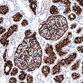 Neprilysin/CD10 was detected in immersion fixed paraffin-embedded sections of human kidney using Rat Anti-Human/Mouse Neprilysin/CD10 Monoclonal Antibody (Catalog # MAB1126) at 0.5 µg/mL for 1 hour at room temperature followed by incubation with the Anti-Rat IgG VisUCyte™ HRP Polymer Antibody (Catalog # VC005). Tissue was stained using DAB (brown) and counterstained with hematoxylin (blue). Specific staining was localized to convoluted tubules and glomeruli. View our protocol for IHC Staining with VisUCyte HRP Polymer Detection Reagents.