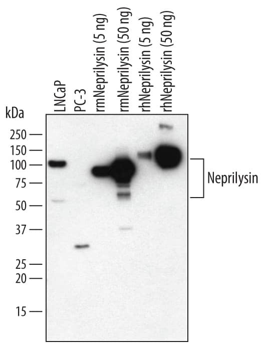 Western blot shows lysates of LNCaP human prostate cancer cell line and PC-3 human prostate cancer cell line. PVDF membrane was probed with 1 µg/mL of Rat Anti-Human/Mouse Neprilysin/CD10 Monoclonal Antibody (Catalog # MAB1126) followed by HRP-conjugated Anti-Rat IgG Secondary Antibody (Catalog # HAF005). For additional reference, Recombinant Mouse Neprilysin (Catalog # 1126-ZN) (5 and 50 ng/lane) and Recombinant Human Neprilysin (CHO-expressed) (Catalog # 1182-ZNC) (5 and 50 ng/lane) were included. Specific bands were detected for Neprilysin/CD10 at approximately 100 kDa (as indicated). This experiment was conducted under reducing conditions and using Immunoblot Buffer Group 1.